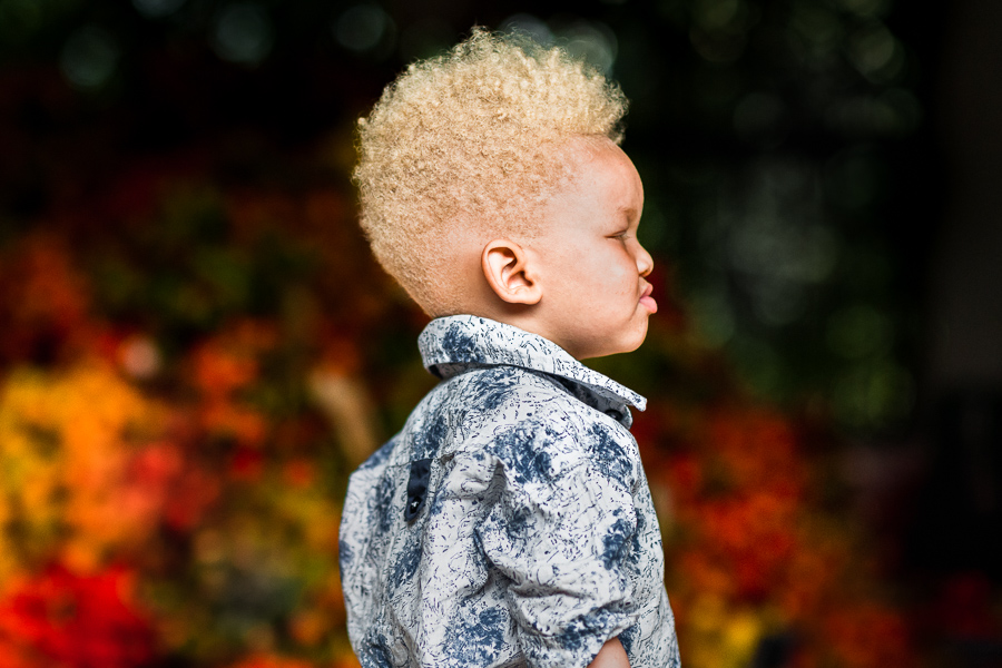 An Afro-Colombian albino boy hangs out during the chontaduro fruit processing in Cali, Colombia.