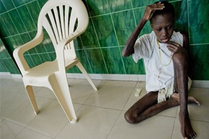 A girl dying of AIDS (Cité Soleil, Port-au-Prince, Haiti)
