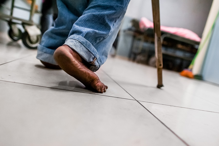 A Salvadoran barefoot man limps in the hospital corridor while seeking a medical help in the emergency department of a public hospital in San Salvador, El Salvador.