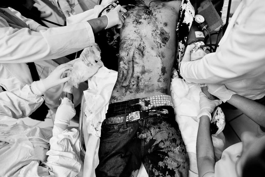 A deadly injured gang member, after being hit by three bullets, is seen lying on an emergency room bed in a state hospital in San Salvador, El Salvador.