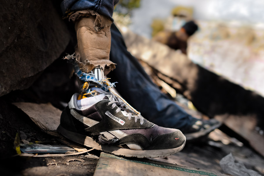 A Honduran immigrant, having his leg amputated by a train during his previous attempt to get illegally to the United States, waits near the railroad track to climb up the train known as ‘La Bestia’ in Mexico City.