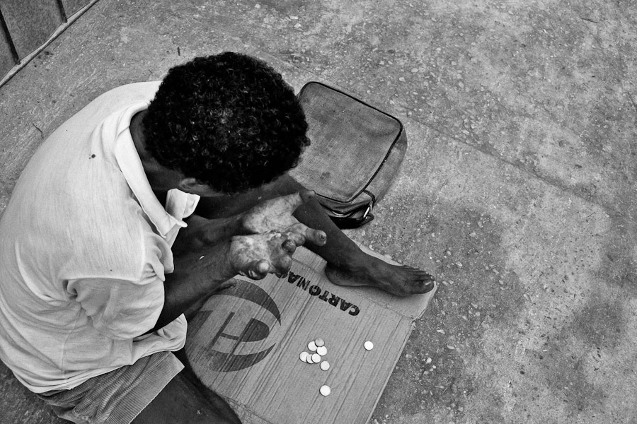 Leprosy-affected man beggs on the street of Belem, Brazil.