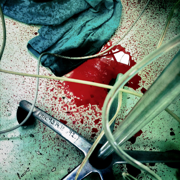 A pool of blood seen on the floor of a surgery room, during a life-saving operation of a young boy, in a state hospital in San Salvador, El Salvador.