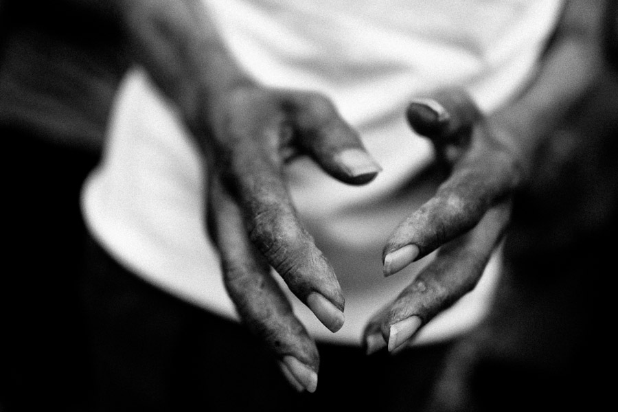 A Colombian man, having a skin rash disease, prays during the religious healing ritual performed at a house church in Bogota, Colombia.