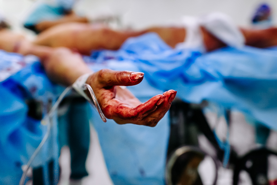 A bloodied hand of a young gang member, with three gunshot wounds, is seen during the life-saving surgery in the operating room of a public hospital in San Salvador, El Salvador.